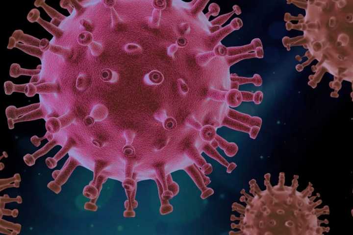 COVID-19: Parts Of US With Low Vaccination Rates Seeing Spike In Cases Linked To Delta Variant